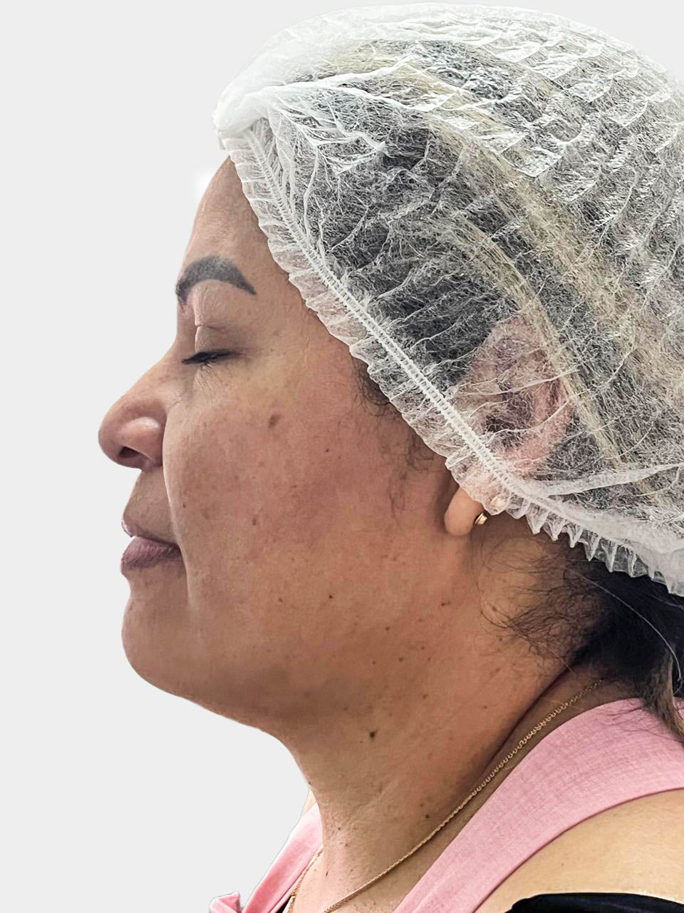 Antes de Hilos Tensores