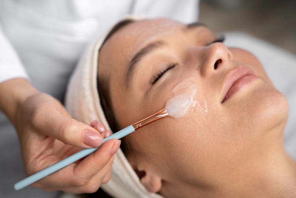 Peeling químico facial
